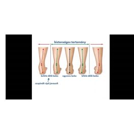 SUPINÁLT azaz döntött sarkú Szamos Kölyök gyermekcipők-INFORMÁCIÓ